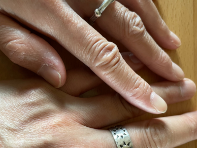 指に竹と太陽のリングをした少し皺のある手が重なっている写真